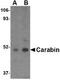 TBC1 Domain Family Member 10C antibody, NBP1-76806, Novus Biologicals, Western Blot image 