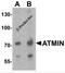ATM Interactor antibody, 7777, ProSci Inc, Western Blot image 