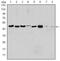 Aurora Kinase A antibody, MA5-15803, Invitrogen Antibodies, Western Blot image 
