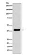 Jun Proto-Oncogene, AP-1 Transcription Factor Subunit antibody, M02038, Boster Biological Technology, Western Blot image 