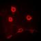 Epithelial Cell Adhesion Molecule antibody, orb10618, Biorbyt, Immunofluorescence image 