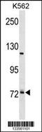 Pre-MRNA Processing Factor 39 antibody, 60-892, ProSci, Western Blot image 