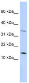 Leptin antibody, TA346171, Origene, Western Blot image 