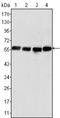 Vimentin antibody, STJ98448, St John