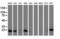 Destrin, Actin Depolymerizing Factor antibody, LS-C337309, Lifespan Biosciences, Western Blot image 