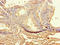 Mitotic checkpoint serine/threonine-protein kinase BUB1 beta antibody, orb41677, Biorbyt, Immunohistochemistry paraffin image 