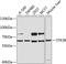 Serine/Threonine Kinase 38 antibody, A04815, Boster Biological Technology, Western Blot image 