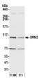 5'-3' Exoribonuclease 2 antibody, A301-103A, Bethyl Labs, Western Blot image 