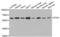 Serine/Threonine Kinase 4 antibody, AHP2528, Bio-Rad (formerly AbD Serotec) , Western Blot image 