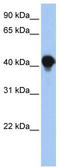 3-Hydroxyacyl-CoA Dehydratase 3 antibody, TA342011, Origene, Western Blot image 