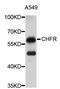 Checkpoint With Forkhead And Ring Finger Domains antibody, STJ23121, St John