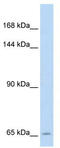 Folate transporter 1 antibody, TA334631, Origene, Western Blot image 