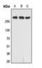 Insulin Like Growth Factor 2 Receptor antibody, orb393323, Biorbyt, Western Blot image 