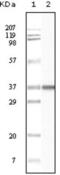 BLK Proto-Oncogene, Src Family Tyrosine Kinase antibody, abx015724, Abbexa, Enzyme Linked Immunosorbent Assay image 