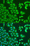 F-actin-capping protein subunit beta antibody, 23-404, ProSci, Immunofluorescence image 