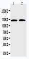 Solute carrier family 12 member 6 antibody, PA5-80005, Invitrogen Antibodies, Western Blot image 