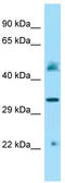 Iduronidase Alpha-L- antibody, TA343326, Origene, Western Blot image 