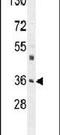 MPR46 antibody, PA5-24608, Invitrogen Antibodies, Western Blot image 