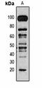 Cell Death Inducing P53 Target 1 antibody, orb75150, Biorbyt, Western Blot image 