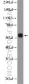 Mixed Lineage Kinase Domain Like Pseudokinase antibody, 21066-1-AP, Proteintech Group, Western Blot image 