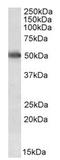 Cytochrome P450 Family 2 Subfamily E Member 1 antibody, AP22383PU-N, Origene, Western Blot image 