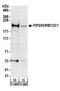 RB1 Inducible Coiled-Coil 1 antibody, A301-536A, Bethyl Labs, Western Blot image 