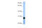 SLG antibody, 30-584, ProSci, Enzyme Linked Immunosorbent Assay image 