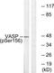 Vasodilator Stimulated Phosphoprotein antibody, TA312097, Origene, Western Blot image 