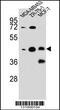 hCG_1645727 antibody, 56-241, ProSci, Western Blot image 