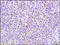 Kinase Insert Domain Receptor antibody, 250909, Abbiotec, Immunohistochemistry paraffin image 