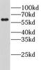 Lysophosphatidylcholine Acyltransferase 1 antibody, FNab04825, FineTest, Western Blot image 