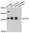 ETHE1 Persulfide Dioxygenase antibody, A05557, Boster Biological Technology, Western Blot image 