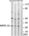 Mitochondrial Ribosomal Protein L10 antibody, TA316074, Origene, Western Blot image 