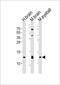 Hemoglobin Subunit Gamma 2 antibody, PA5-49336, Invitrogen Antibodies, Western Blot image 