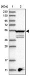 Tubulin Epsilon 1 antibody, PA5-56916, Invitrogen Antibodies, Western Blot image 