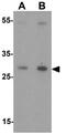 MRG-1 antibody, GTX31503, GeneTex, Western Blot image 