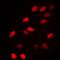 Nuclear Receptor Corepressor 1 antibody, orb214916, Biorbyt, Immunofluorescence image 
