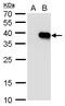 Homeobox A5 antibody, PA5-35897, Invitrogen Antibodies, Western Blot image 