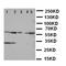 DRASIC antibody, orb97064, Biorbyt, Western Blot image 