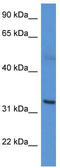 Carbonic Anhydrase 5A antibody, TA342842, Origene, Western Blot image 