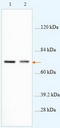 ATP Binding Cassette Subfamily D Member 4 antibody, TA310031, Origene, Western Blot image 