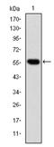 Chaperonin Containing TCP1 Subunit 2 antibody, AM06677SU-N, Origene, Western Blot image 