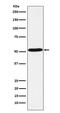 5-Hydroxytryptamine Receptor 7 antibody, M05018, Boster Biological Technology, Western Blot image 