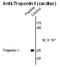 Troponin I3, Cardiac Type antibody, AP26442PU-N, Origene, Western Blot image 