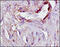 Cadherin 3 antibody, 251528, Abbiotec, Immunohistochemistry paraffin image 