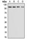 Serine/threonine-protein phosphatase 4 regulatory subunit 3A antibody, orb412758, Biorbyt, Western Blot image 