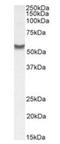 Solute Carrier Family 7 Member 6 antibody, orb389378, Biorbyt, Western Blot image 