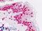 Nuclear Factor I A antibody, LS-B9077, Lifespan Biosciences, Immunohistochemistry paraffin image 