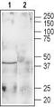 Galanin Receptor 1 antibody, TA328849, Origene, Western Blot image 