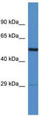 Adhesion Molecule With Ig Like Domain 2 antibody, TA333380, Origene, Western Blot image 